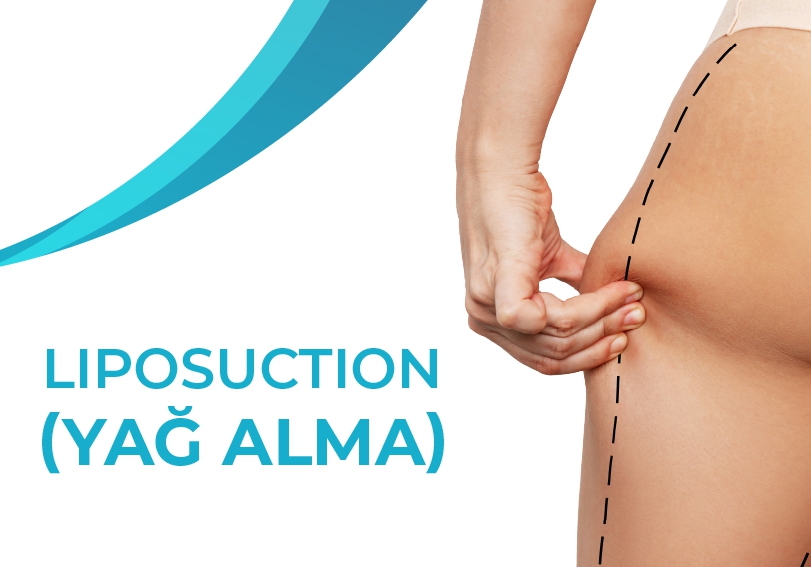 Liposuction (Yağ Alma)